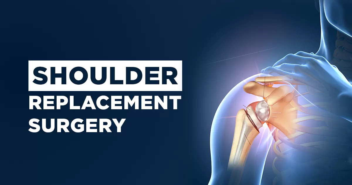 Shoulder Replacement Surgery in Ghaziabad
